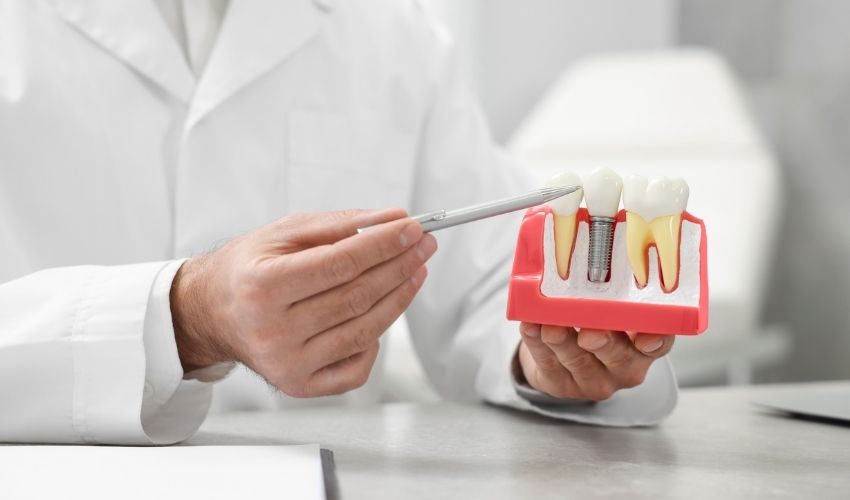 Diş hekiminin dental implant modeli üzerinde açıklama yapması