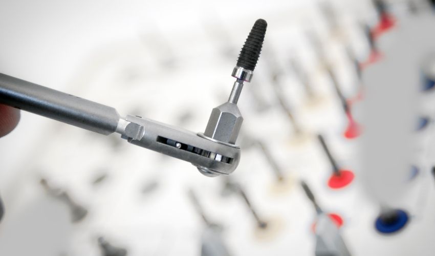 Diş implantı uygulamasında kullanılan farklı implant türleri ve ekipmanları.