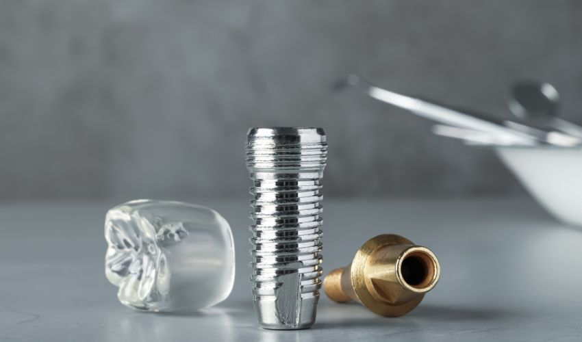 Diş implant malzemeleri: Titanyum vida, abutment ve protez diş örneği.