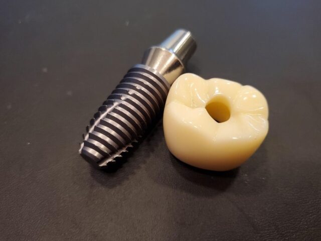 zirkonyum implant zirkonyum implant